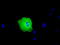Peroxisomal Biogenesis Factor 5 antibody, TA501430, Origene, Immunofluorescence image 