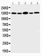 Prominin-1 antibody, PA2049, Boster Biological Technology, Western Blot image 