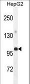 Glycerol-3-Phosphate Acyltransferase, Mitochondrial antibody, LS-C166594, Lifespan Biosciences, Western Blot image 