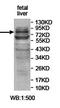 Arachidonate Lipoxygenase 3 antibody, orb78158, Biorbyt, Western Blot image 
