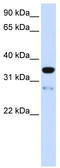 Transmembrane Protein 38A antibody, TA338647, Origene, Western Blot image 
