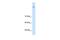 Neuronal Cell Adhesion Molecule antibody, GTX46617, GeneTex, Western Blot image 