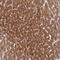 Zinc Finger Protein 584 antibody, HPA043408, Atlas Antibodies, Immunohistochemistry paraffin image 