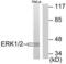 Interferon Induced Protein 44 antibody, abx013071, Abbexa, Western Blot image 
