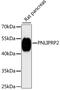 Pancreatic Lipase Related Protein 2 (Gene/Pseudogene) antibody, 14-689, ProSci, Western Blot image 