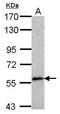 Semaphorin 6C antibody, GTX118489, GeneTex, Western Blot image 