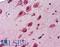 Ubiquilin 1 antibody, LS-B3574, Lifespan Biosciences, Immunohistochemistry paraffin image 