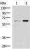 Adaptor Related Protein Complex 1 Subunit Mu 2 antibody, A10144, Boster Biological Technology, Immunohistochemistry paraffin image 