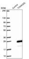 Translocase Of Outer Mitochondrial Membrane 20 Like antibody, NBP1-93437, Novus Biologicals, Western Blot image 