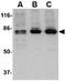 Protein Tyrosine Kinase 7 (Inactive) antibody, GTX31322, GeneTex, Western Blot image 
