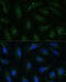 Coatomer Protein Complex Subunit Gamma 2 antibody, 16-252, ProSci, Immunofluorescence image 