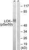 LCK Proto-Oncogene, Src Family Tyrosine Kinase antibody, PA5-39760, Invitrogen Antibodies, Western Blot image 