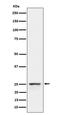 Peroxisomal Biogenesis Factor 11 Beta antibody, M08864, Boster Biological Technology, Western Blot image 