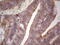 Tumor necrosis factor receptor superfamily member 18 antibody, M03125-2, Boster Biological Technology, Immunohistochemistry paraffin image 