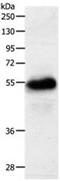 Solute Carrier Family 22 Member 6 antibody, orb107599, Biorbyt, Western Blot image 