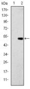 Glucokinase antibody, M00884, Boster Biological Technology, Western Blot image 