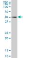 HNF1 Homeobox B antibody, H00006928-M02, Novus Biologicals, Western Blot image 