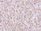 Coatomer Protein Complex Subunit Beta 1 antibody, PA5-29443, Invitrogen Antibodies, Immunohistochemistry paraffin image 