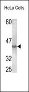 Caspase 4 antibody, 252221, Abbiotec, Western Blot image 