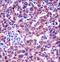 Glycophorin B (MNS Blood Group) antibody, LS-C166748, Lifespan Biosciences, Immunohistochemistry paraffin image 