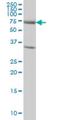 Exocyst Complex Component 7 antibody, H00023265-M01, Novus Biologicals, Western Blot image 