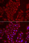 Tripeptidyl Peptidase 2 antibody, 22-207, ProSci, Immunofluorescence image 