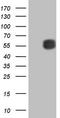 Matrix Metallopeptidase 3 antibody, LS-C791078, Lifespan Biosciences, Western Blot image 