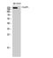 Cytoplasmic Linker Associated Protein 1 antibody, A04813-1, Boster Biological Technology, Western Blot image 