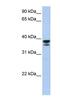 Galectin 9 antibody, NBP1-58336, Novus Biologicals, Western Blot image 