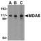 Interferon Induced With Helicase C Domain 1 antibody, TA306392, Origene, Western Blot image 