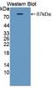 Carnitine Palmitoyltransferase 2 antibody, LS-C372960, Lifespan Biosciences, Western Blot image 