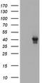 Tubulin-specific chaperone C antibody, TA504734, Origene, Western Blot image 