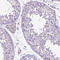 Cadherin 1 antibody, HPA004812, Atlas Antibodies, Immunohistochemistry frozen image 