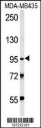 Thyrotropin Releasing Hormone Degrading Enzyme antibody, 61-995, ProSci, Western Blot image 