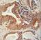 Insulin Like Growth Factor 2 MRNA Binding Protein 1 antibody, LS-C165144, Lifespan Biosciences, Immunohistochemistry frozen image 