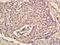 Elongin A antibody, orb101126, Biorbyt, Immunohistochemistry paraffin image 