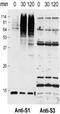 Small Ubiquitin Like Modifier 1 antibody, ab5316, Abcam, Western Blot image 