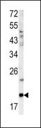 Glucagon antibody, PA5-13442, Invitrogen Antibodies, Western Blot image 