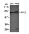 Protein Kinase C Zeta antibody, orb14687, Biorbyt, Western Blot image 