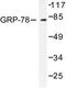 Heat Shock Protein Family A (Hsp70) Member 5 antibody, LS-C176049, Lifespan Biosciences, Western Blot image 