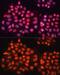 ATP Binding Cassette Subfamily B Member 8 antibody, GTX64900, GeneTex, Immunocytochemistry image 