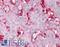 Beta-2-Microglobulin antibody, LS-B1858, Lifespan Biosciences, Immunohistochemistry frozen image 