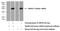 GRB2 Related Adaptor Protein 2 antibody, 11894-1-AP, Proteintech Group, Western Blot image 