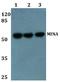 Ribosomal Oxygenase 2 antibody, A32122-1, Boster Biological Technology, Western Blot image 