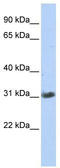 Zinc Finger AN1-Type Containing 3 antibody, TA345344, Origene, Western Blot image 