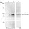 E2F-1 antibody, 71-151, BioAcademia Inc, Immunoprecipitation image 