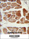 RuvB Like AAA ATPase 1 antibody, 60-402, ProSci, Immunohistochemistry paraffin image 