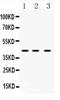 Heterogeneous Nuclear Ribonucleoprotein F antibody, PA5-79382, Invitrogen Antibodies, Western Blot image 