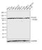 Signal Transducer And Activator Of Transcription 6 antibody, MA5-15659, Invitrogen Antibodies, Western Blot image 