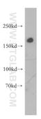 CD206 antibody, 18704-1-AP, Proteintech Group, Western Blot image 